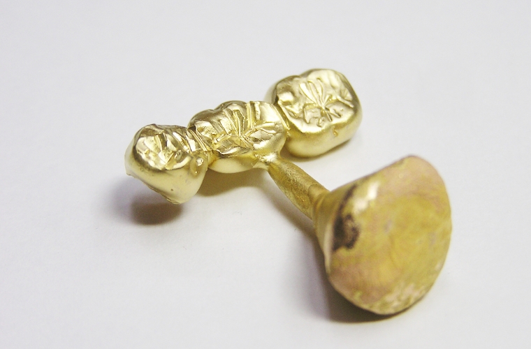 金歯・歯科用金属